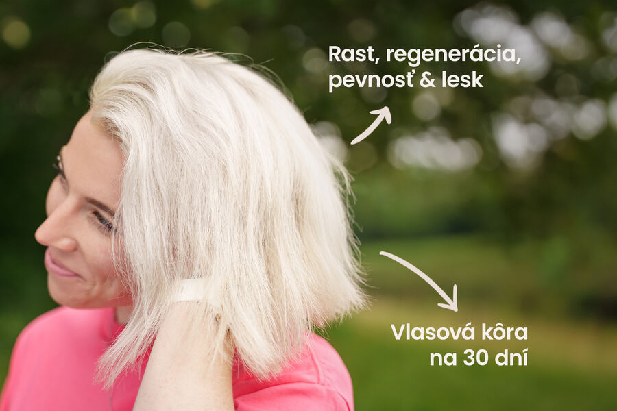 Zdravé vlasy – HAIR BOOST L-metionín & D-biotín