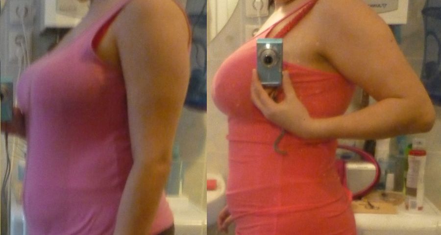 Žena, ktorá chudne s proteínovou diétou, na fotke pred svojou chudnúcou premenou a po 3 týždňoch s KetoDiet.